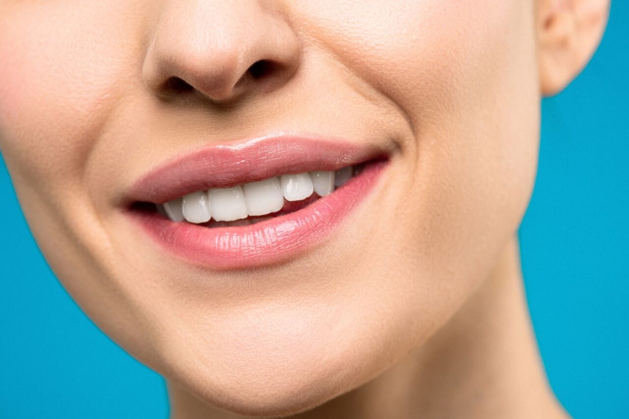 En esta fotografía, vemos a una mujer con una dentadura blanca