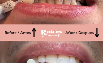 Clínica Dental Raíces
