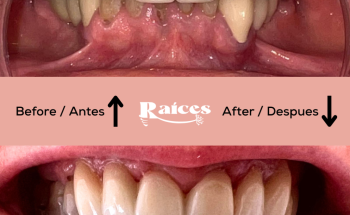 Clínica Dental Raíces