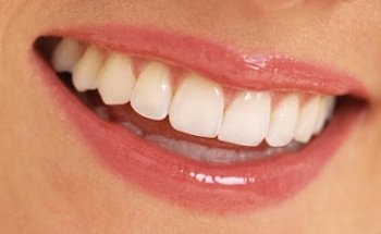 Clínica Dental Antilla