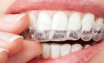 Clinica Dental Rivera Bindon