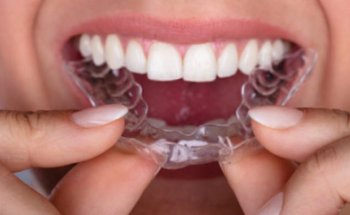 John Smile Ortodoncia con Alineadores Invisibles