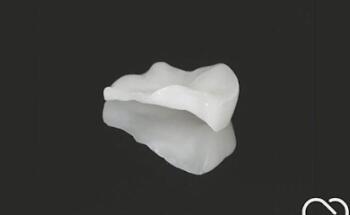 Clínica dental Dr. Alejandro Rodríguez l Diseños de sonrisa l Carillas l Coronas dentales l Urgencias