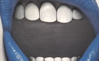 Clínica Dental Cantador Santa Perpetua