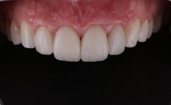 Alvarez - Cañupan Odontología