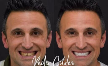 Pedro Citoler