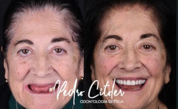 Pedro Citoler