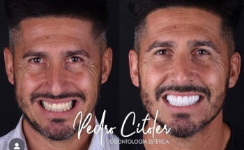 Pedro Citoler