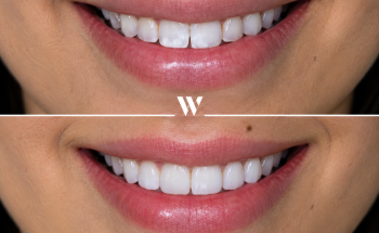 W Dental - Tooting