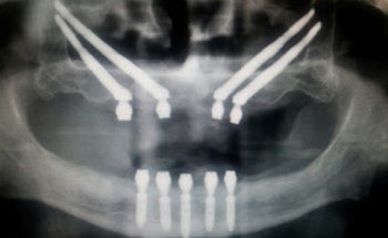 Centre Dental Enric Pintado