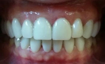 Clínica Dental Tarrés