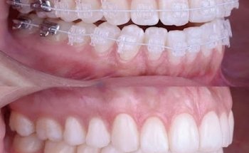 Clinica Albareda24bajo