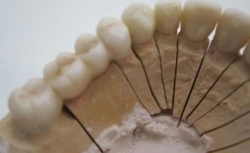 Norder S.L.U Laboratorio de Prótesis Dental