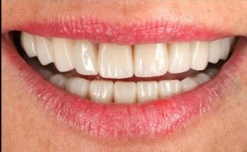 Dentalcom -Odontología Estética-