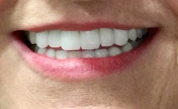 Clínica Dental Dr. Celestino Gómez y Dra. Paula Gómez