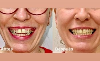 CLÍNICAS ODONTOLÓGICAS RAVOJC