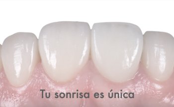 Clínica Dental MiBO Almería