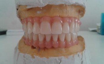 Laboratorio de Prótesis Dental - Carlos Zayas