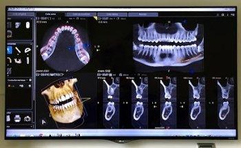 Clínica Dental Dr. Pompeyo - Acueducto