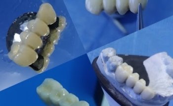 Dentista 24 horas Dr. Vinicio Xalapa Urgencias Dentales