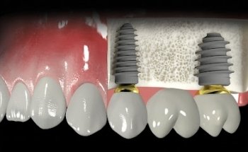 Odontología Familiar Especializada de Aguascalientes