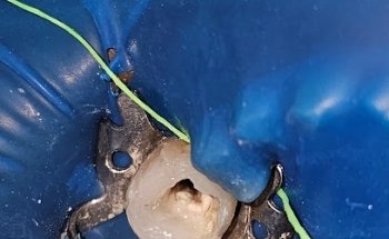 Dr. Fernando Garcia ENDODONCIA