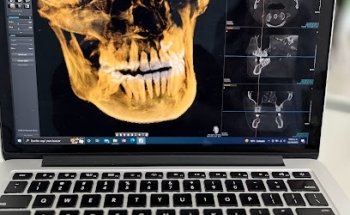 Isdental | Odontología Especializada