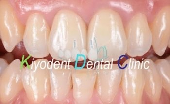 Kiyodent Dental Clinic Chapultepec