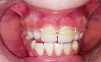 Dentista SmileMed - Clínica Dental