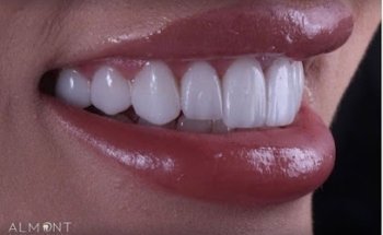 Almont Dental Center