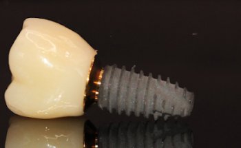 Wellness dental clinic