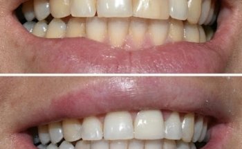 Downtown Dental Clinic