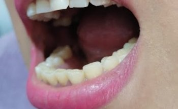 URGENCIAS DENTALES/PREVIA CITA