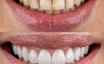 Tijuana Clinic for Cosmetic Dentistry