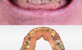 PACIFIC DENTAL TIJUANA