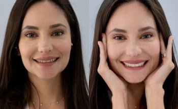 DR LUIS MELO/ORTODONTICA