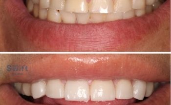 Tijuana Dentist | Clinica Dental Integral