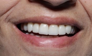 Dr. Estrada - Cosmetic Dentistry Nuevo Progreso.