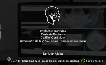 Implantes Dentales / Carillas Dentales / Dr. Ivan Meza