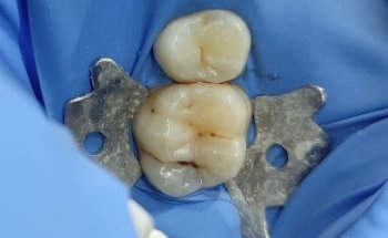 ImplaOden, Clínica Dental