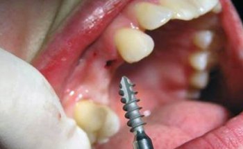 Clínica Dental Funnydent ( Dentistas en Matamoros )