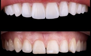 Smiles Spa By Dr. Roberto Zamudio