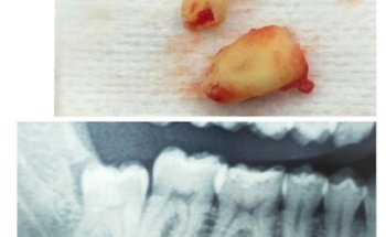 Centro de Cirugía Maxilofacial y Atención Dental