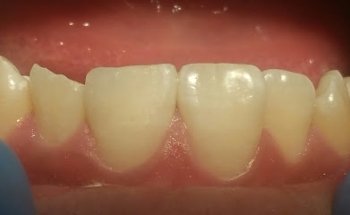 Dentista - Dr. Jonathan Ramirez - Praxia Odontológica