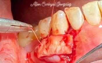 Endodoncia - Periodoncia & Odontopediatría