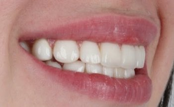 Dra.Laura Rojas-Odontología Integral