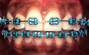 Núcleo Dental Rubén Illán