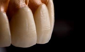 Dr. Ricardo Lemus, Rehabilitación Oral Estética e Implantología Dental