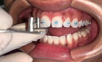 OrthoImplant Doctores Alonso Especialistas con Maestría BUAP.