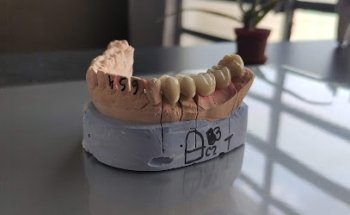 Consultorio dental Mérida | Dentista emergencias